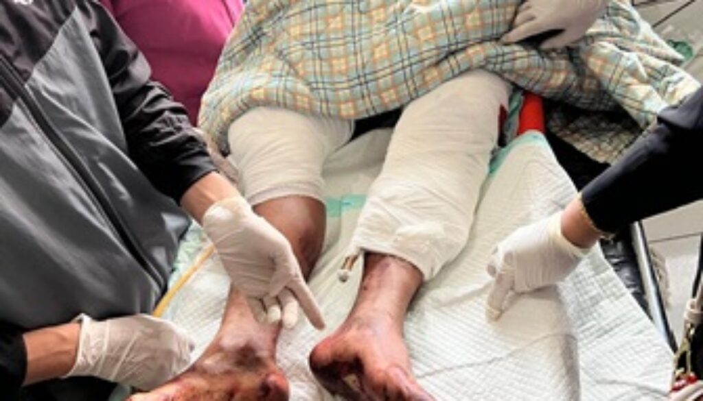 Anggota Polwk Ilu yang dibacok OTK telah dirawat di RS Bhayangkara Jayapura Anggota Polwk Ilu yang dibacok OTK telah dirawat di RS Bhayangkara Jayapura