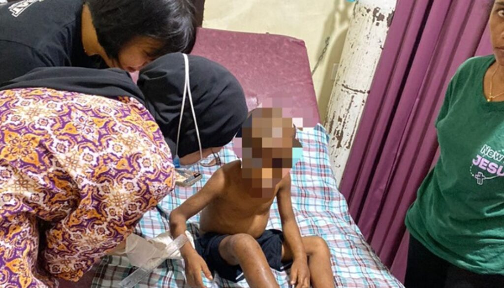 Bocah malang korban kekerasan Pasutri di Organda kini dirawat di RS Bhayangkara Bocah malang korban kekerasan Pasutri di Organda kini dirawat di RS Bhayangkara