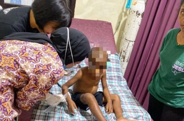 Bocah malang korban kekerasan Pasutri di Organda kini dirawat di RS Bhayangkara